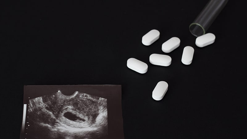 À quel point l’avortement médicamenteux est-il douloureux ?