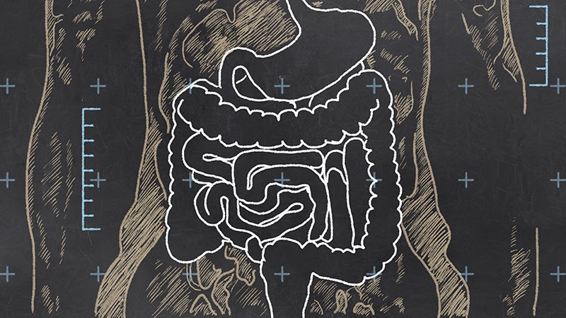 Les cellules souches adultes peuvent guérir les fistules de Crohn périanales intraitables
