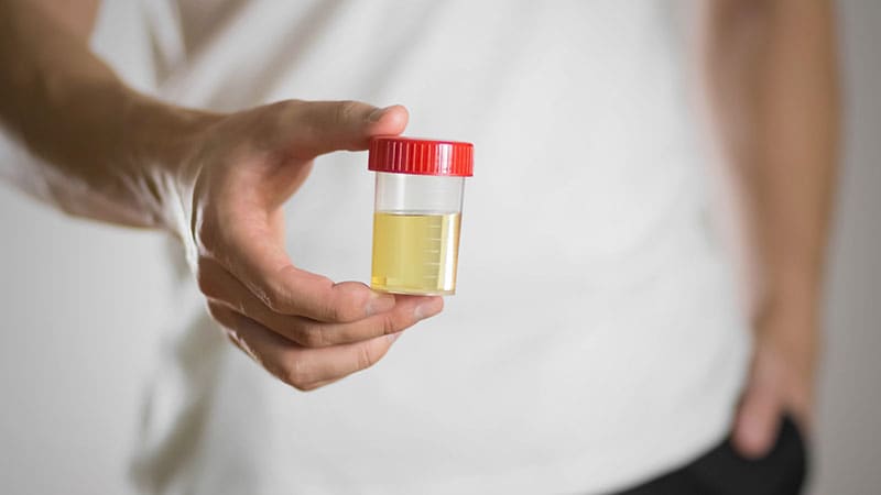 Surveillez les « pics » de buprénorphine dans les tests de dépistage de drogues dans l’urine