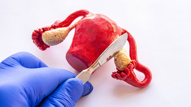 Les ovariectomies continuent de dominer le traitement de la torsion