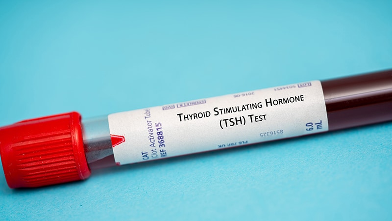 Thyroid Test: Seasonal Variation May Lead to Overprescribing