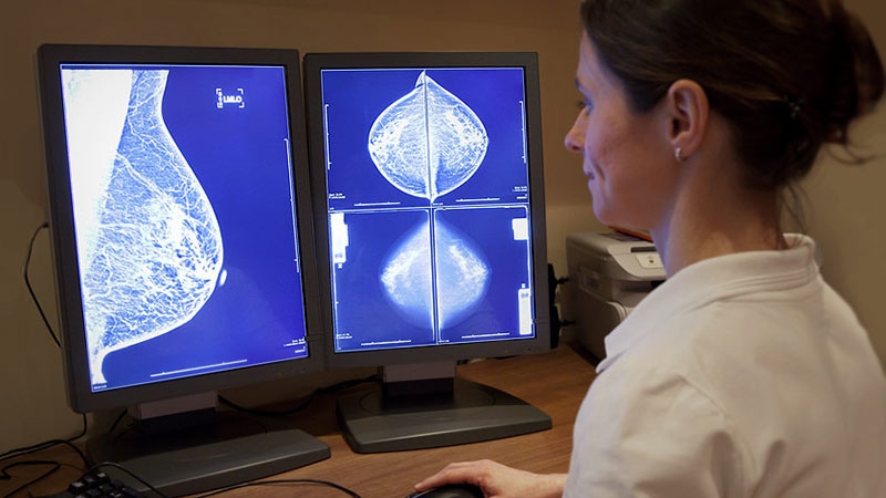 AI Improves Mammography Accuracy, Reduces Workload