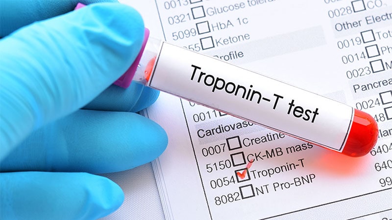 Age-Specific Cut-Offs Needed for Cardiac Troponin Tests?