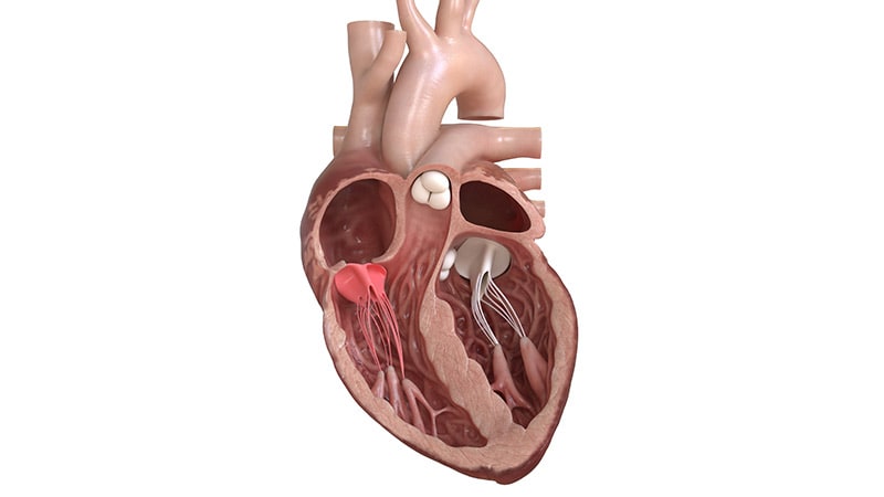 Transcatheter Tricuspid Valve Restore Efficient in Actual World