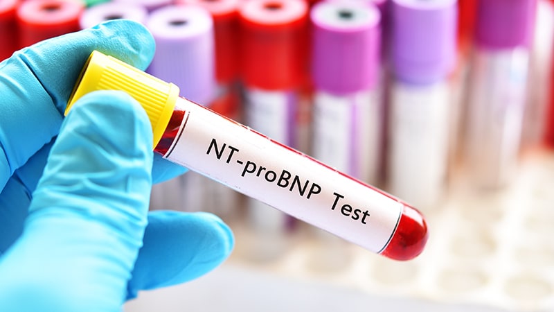 ARNI surpasse ARB pour réduire le NT-proBNP dans le HFpEF stabilisé