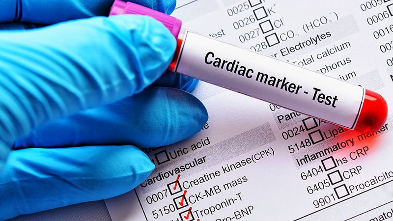 Troponin to ID Diabetes Patients With Silent Heart Disease?