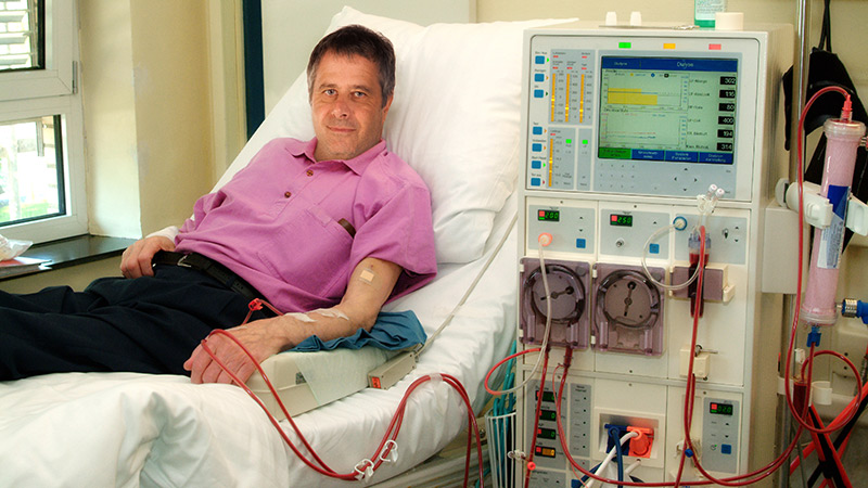 Une nouvelle technique de dialyse améliore la survie en cas d’insuffisance rénale