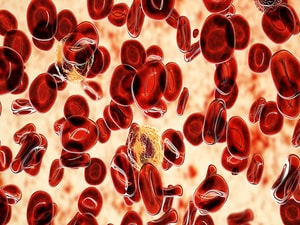 Novel Drug Shows 'Impressive' Efficacy in Polycythemia Vera