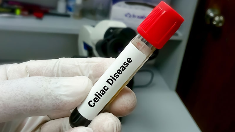 No-Biopsy Approach to Celiac Disease Diagnosis Safe for Some