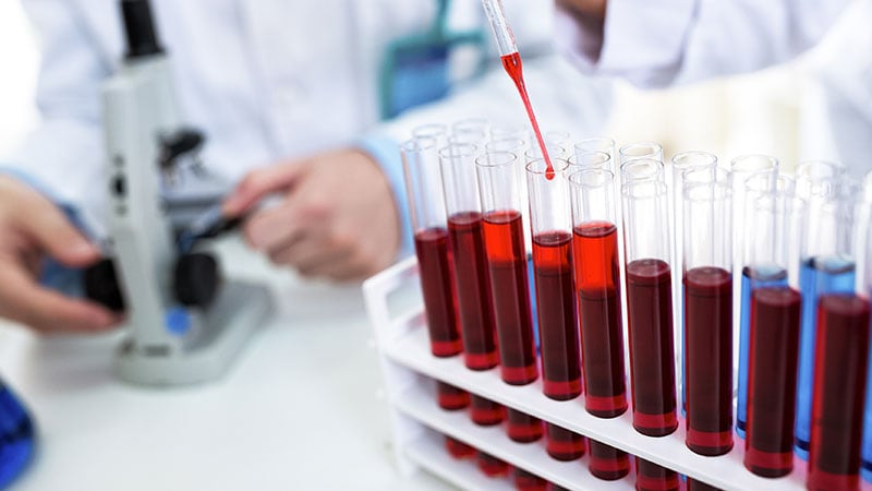Les personnes atteintes d’un long COVID ont des biomarqueurs sanguins spécifiques : étude