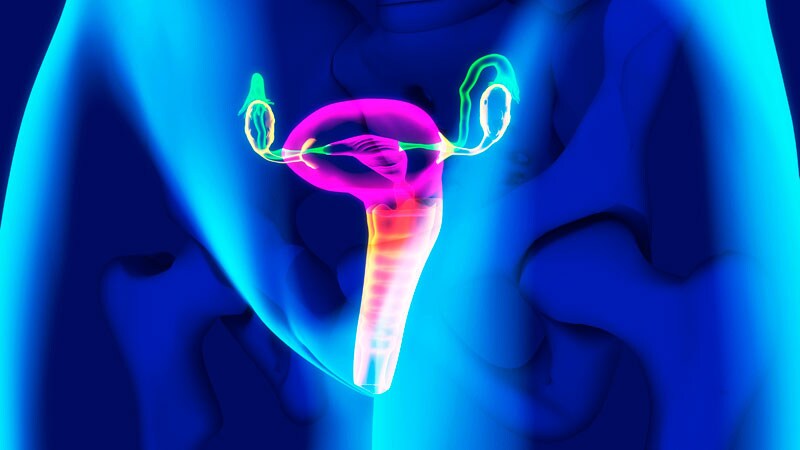 De nouvelles études éclairent les meilleures pratiques pour le prolapsus des organes pelviens