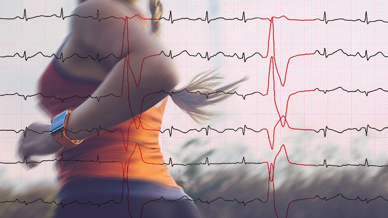 post-exercise-pvcs-tied-to-higher-cv-mortality-risk