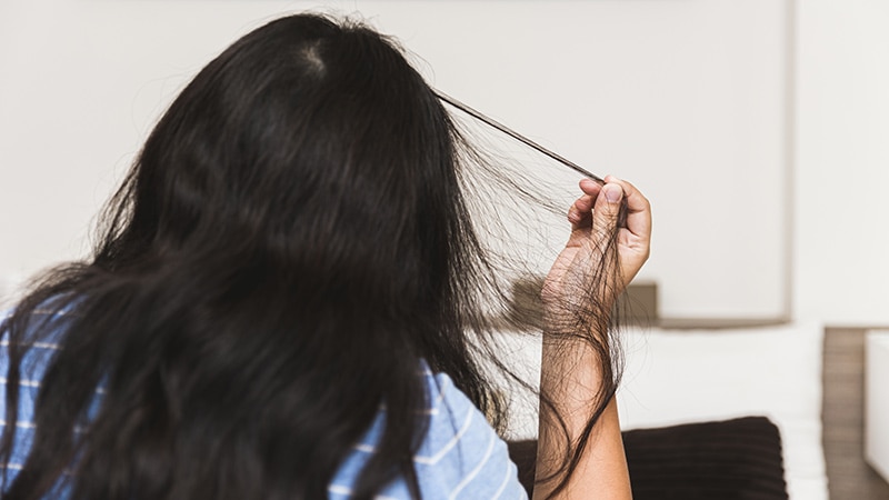 Trichotillomania: A Primer on a Common Hair-Pulling Disorder