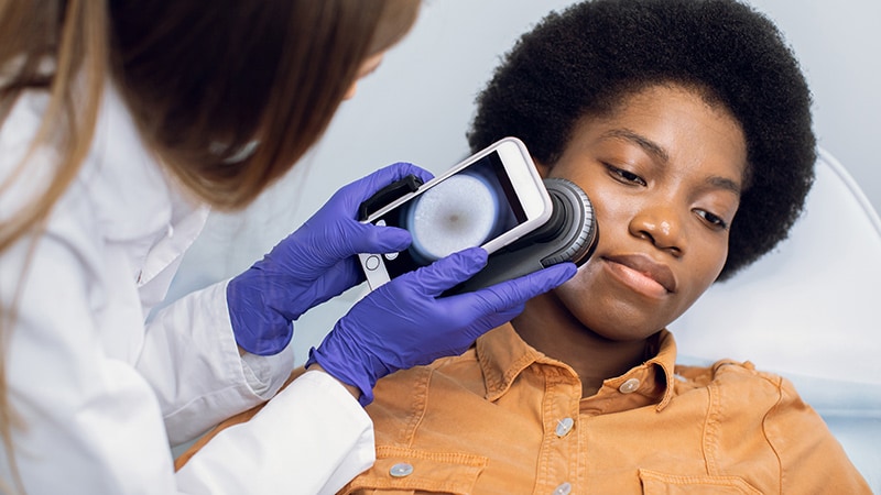 Une étude révèle que les décisions de biopsie et les diagnostics diffèrent selon le type de peau