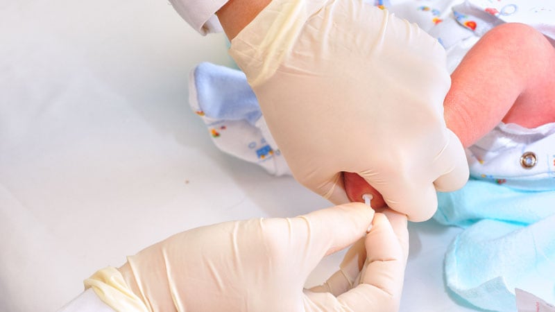 Le biomarqueur sanguin au talon peut identifier le risque de SMSN