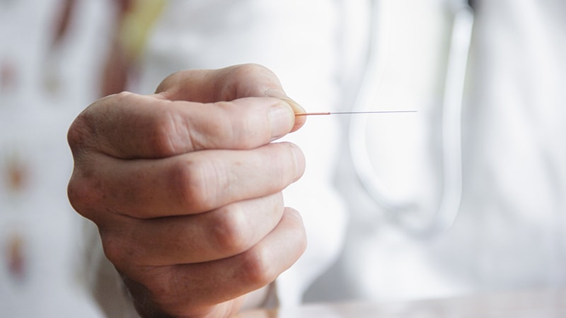 Acupuncture Deep Needling Points to Greater Headache Relief