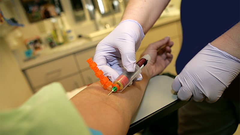 Un simple test sanguin pourrait diagnostiquer la NASH, la fibrose