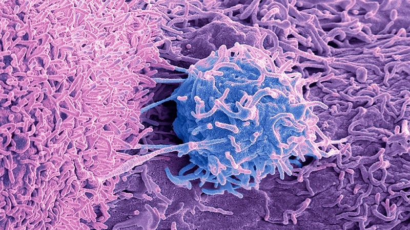 Cabazitaxel vs privation d’androgènes dans le cancer de la prostate métastatique