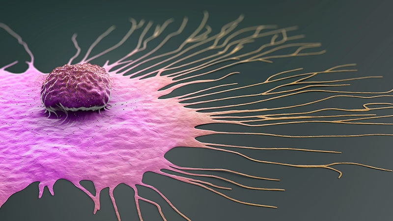 Le temps est venu pour le test génétique universel de la lignée germinale dans le cancer du sein