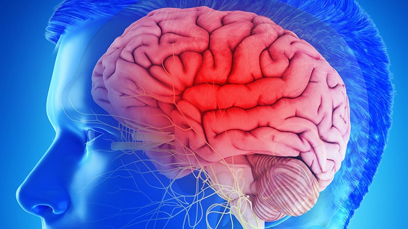 COVID-19 affecte le cerveau 6 mois après les symptômes, selon la recherche