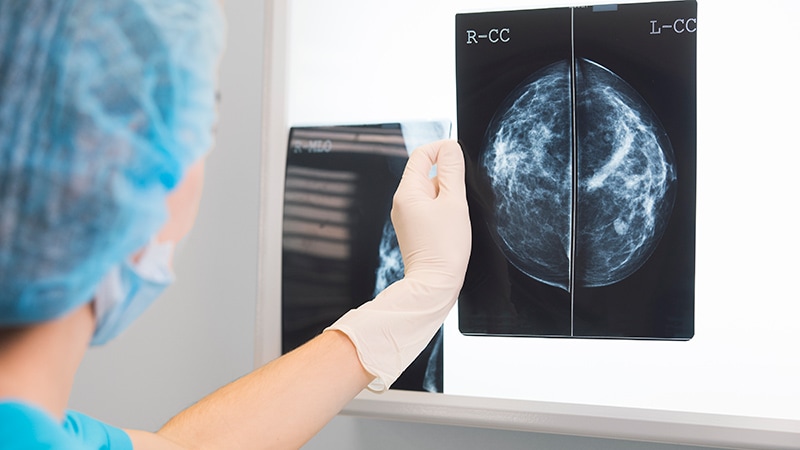 Le dépistage par mammographie IA est équivalent aux lecteurs humains