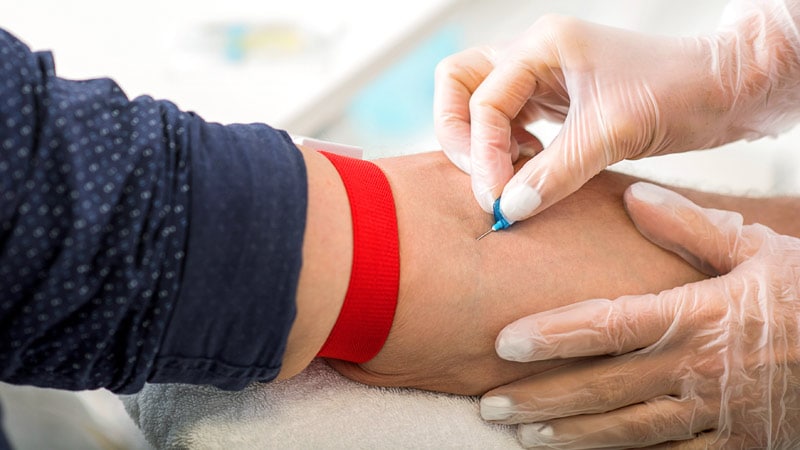 FDA eases restrictions on blood donation for gay and bisexual men