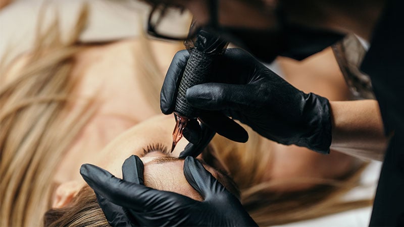 Lasers picosecondes efficaces pour traiter les tatouages ​​cosmétiques