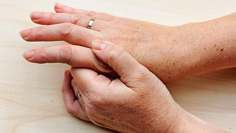 Un essai positif sur le méthotrexate dans l’arthrose de la main donne des résultats modestes