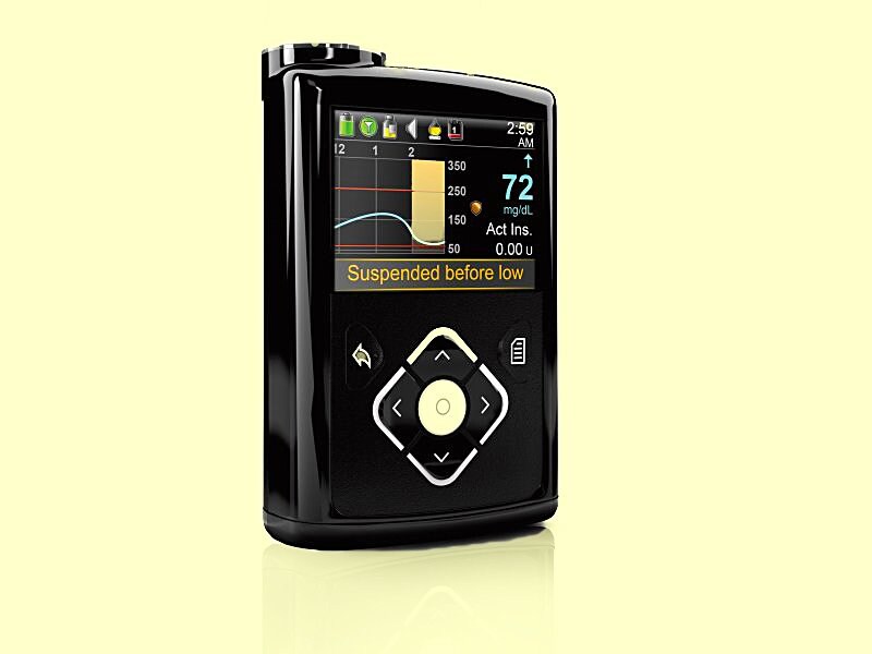 Medtronic Artificial Pancreas >> New Insulin Pump Prompts 'First Artificial Pancreas' Headlines Medtronic Artificial Pancreas >> New Insulin Pump Prompts 'First Artificial Pancreas' Headlines