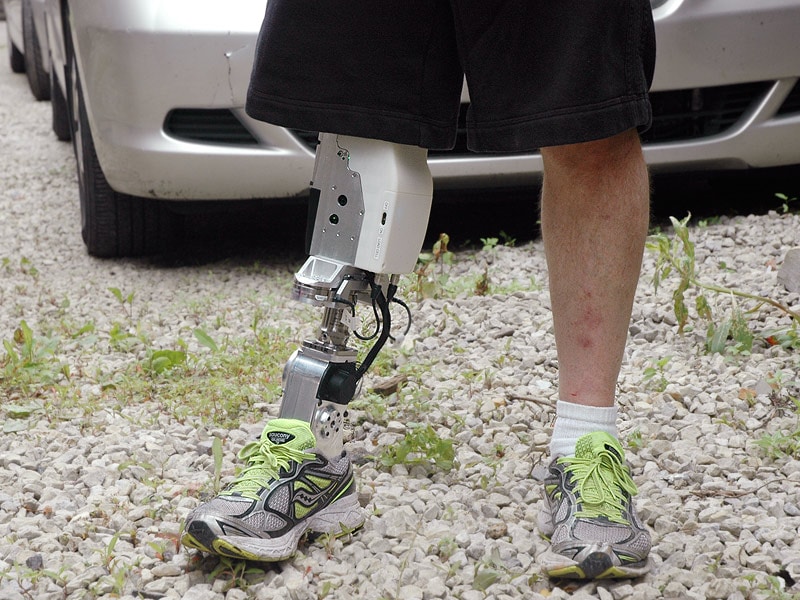 Powered Prosthetic Leg on the Horizon