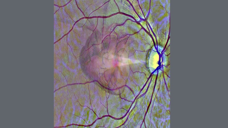 “以眼观心”扫描视网膜，AI可知心脏病风险