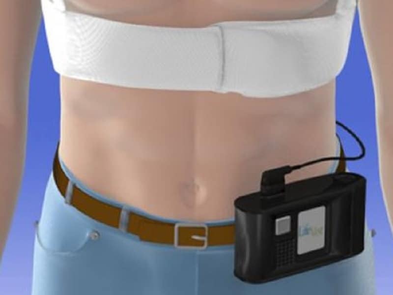 LifeVest a CostEffective Bridge If ICD Removed for Infection