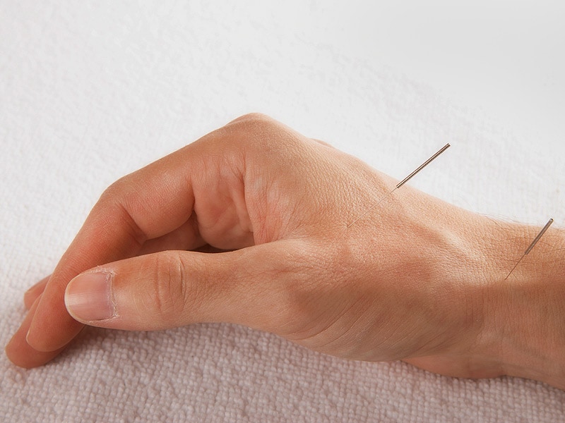 Acupuncture Causes Brain Changes in Patients With Hand Pain