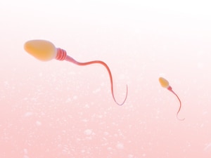 Small Varicoceles Can Make a Big Difference in Sperm Quality