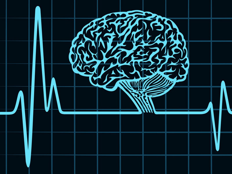 cerebral-function-assessment