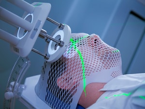 Adjuvant Whole-Brain Radiotherapy: End of an Era?