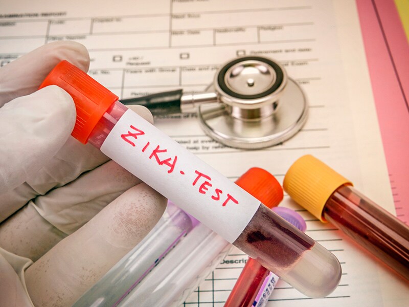 Zika To Test or Not to Test?