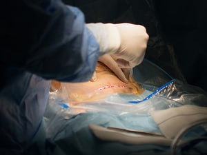 High Cesarean Delivery Rates Disputed at ACOG
