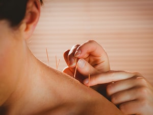 Acupuncture for Chronic Pain: Unprecedented Advances