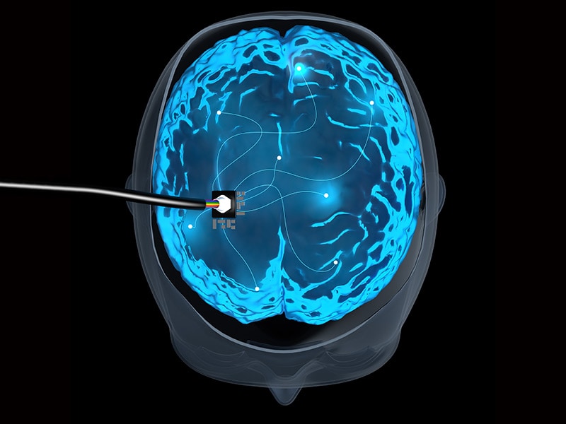 Brain surgery for bipolar disorder