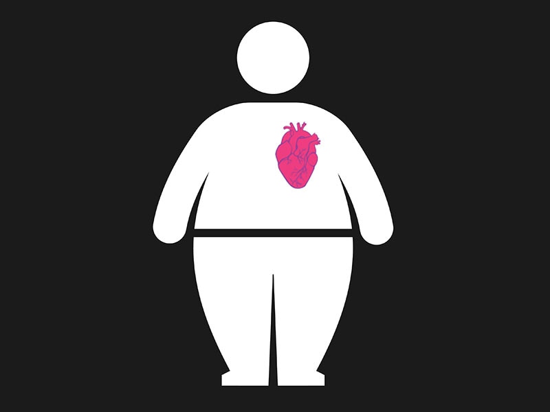 Obesity Paradox in Heart Disease Challenged by New Analysis