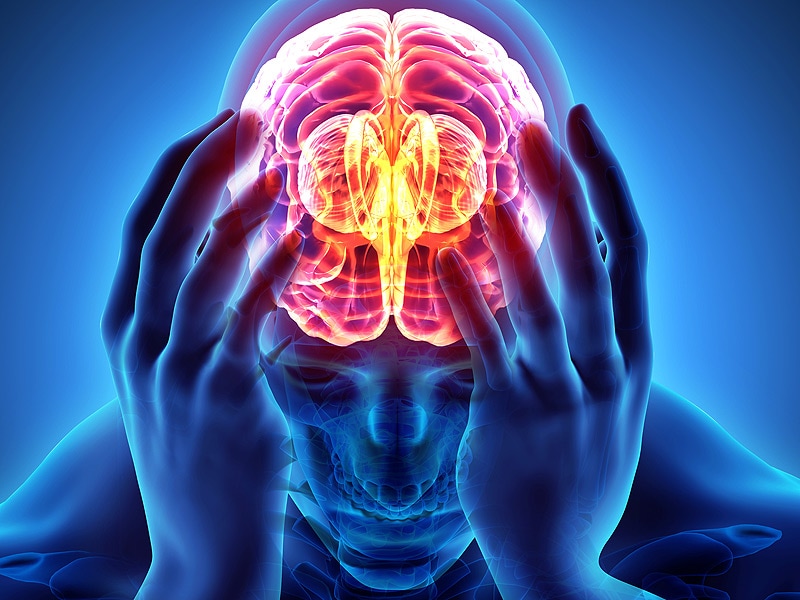 Eptinezumab Safe, Effective for Migraine Prevention