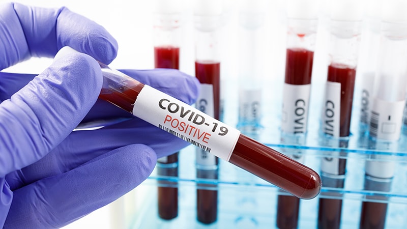 What to Do When Recovered COVID-19 Patients Still Test Positive?