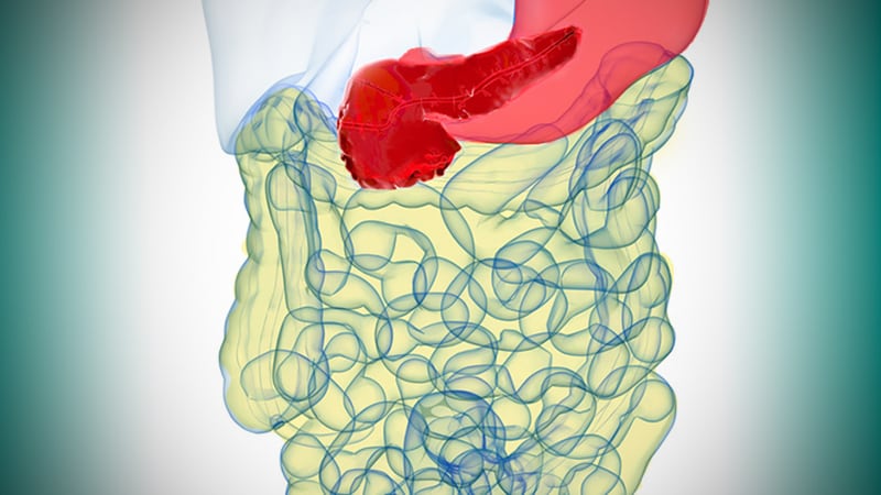 Nouveaux essais sur les cancers gastro-intestinaux non CCR : votre patient pourrait-il en bénéficier ?