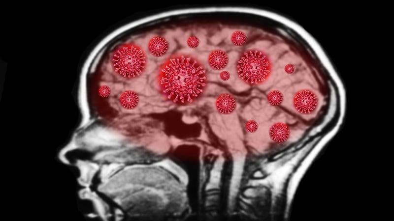 severe brain fog covid