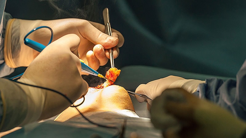 Une radiothérapie à haute dose après une mastectomie pourrait « changer la donne »