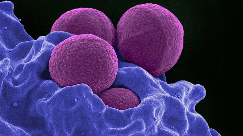 Un nouvel antibiotique pourrait combattre les superbactéries multirésistantes