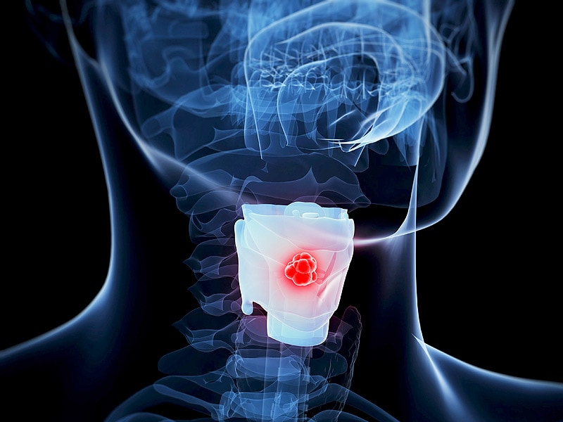 HPV16 Antibodies Signal Even Better Oral Cancer Outcomes