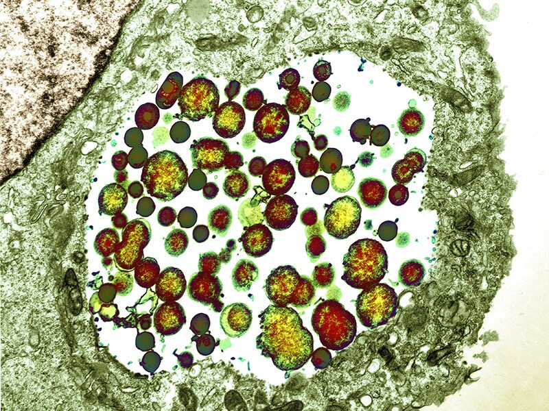 Doxycycline Barely Beats Azithromycin For Chlamydia