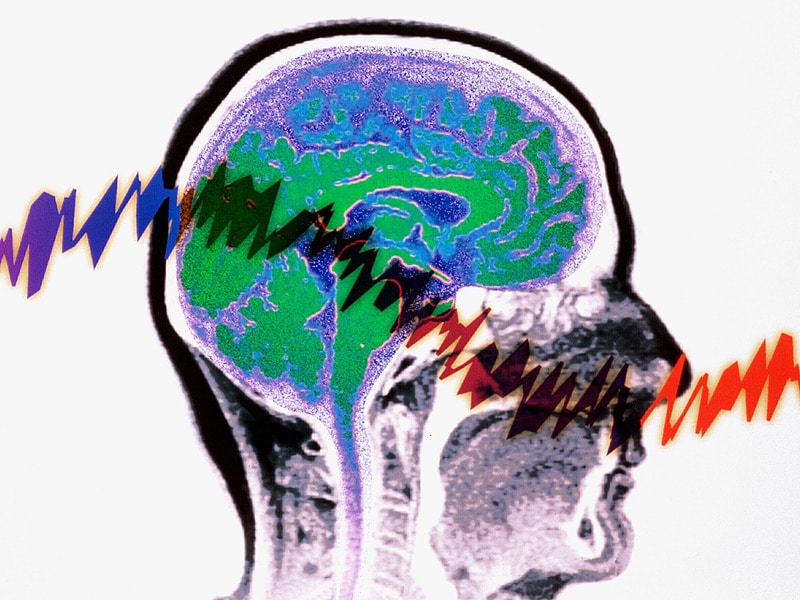 new-definition-of-status-epilepticus